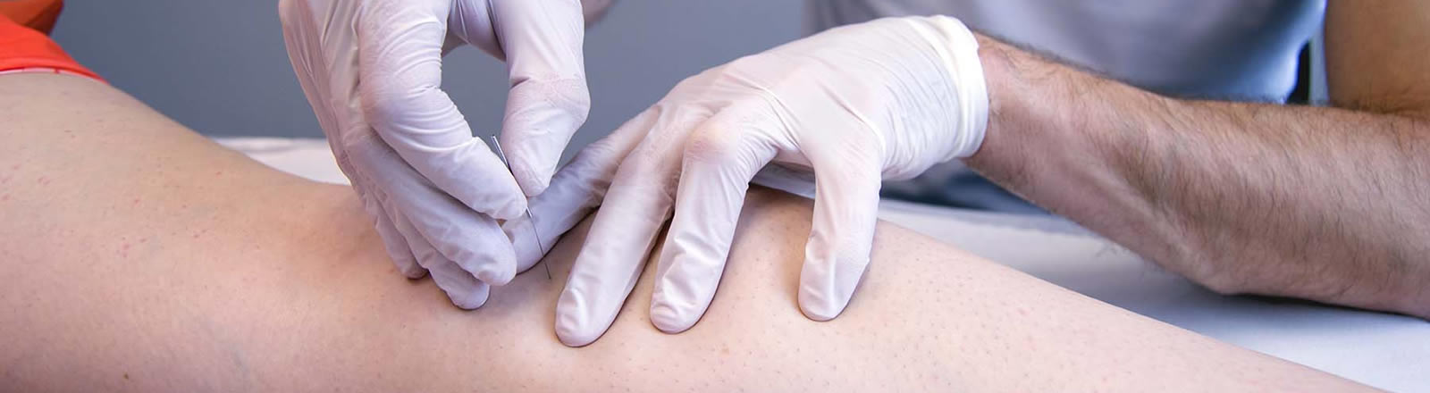 Puncion seca para contracturas musculares