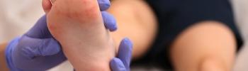 Dolor de talón en niños en Logroño puede ser síndrome de Sever