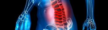 Abordaje fisioterapéutico en la hernia discal lumbar - FisioClinics Logroño