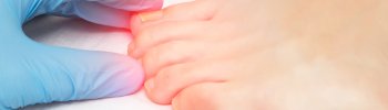 Metatarsalgia - Diagnóstico y tratamiento