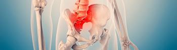 Abordaje de la Sacroileítis desde la fisioterapia Integrativa - FisioClinics Logroño Abordaje de la Sacroileítis desde la fisioterapia Integrativa - FisioClinics Logroño