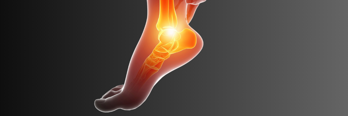 Técnicas de rehabilitación para pacientes con talalgia crónica