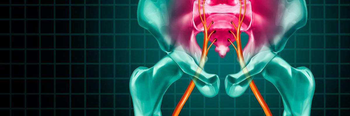 ¿Cuál es el abordaje a través de la fisioterapia para la ciatalgia? - FisioClinics Logroño