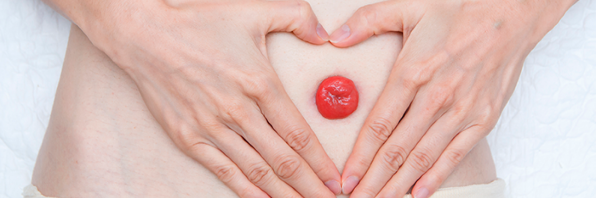 Fisioterapia en Paciente Ostomizado