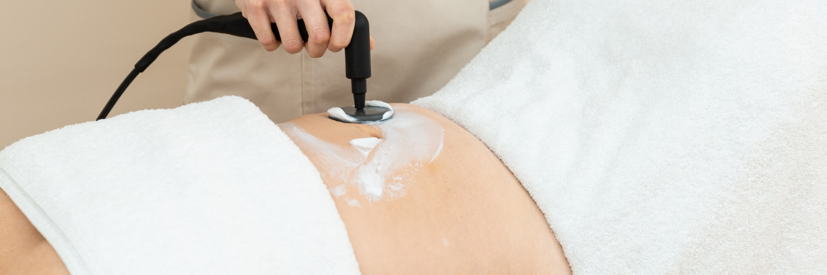 Beneficios de la radiofrecuencia en el suelo pélvico