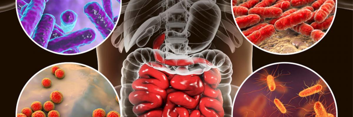 Microbiota en Coloproctología 