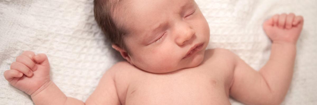 ¿Qué es la tortícolis muscular congénita y cuál es su abordaje a través de la fisioterapia?  FisioClinics Logroño